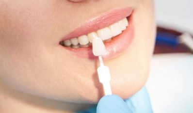 Close up of woman sitting in dental chair while doctor choosing color tone of female teeth before dental implantology procedure