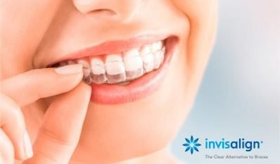 invisalign